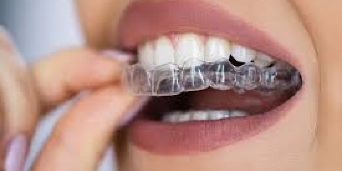 Clear Aligners Market Share: Competitive Landscape and Leadership
